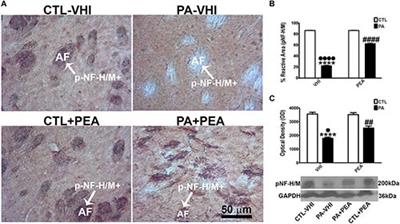 Partial Reversal of Striatal Damage by <mark class="highlighted">Palmitoylethanolamide</mark> Administration Following Perinatal Asphyxia